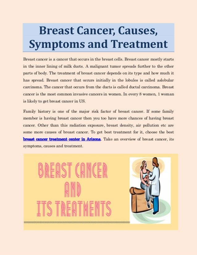 top breast cancer treatment Top breast cancer treatment